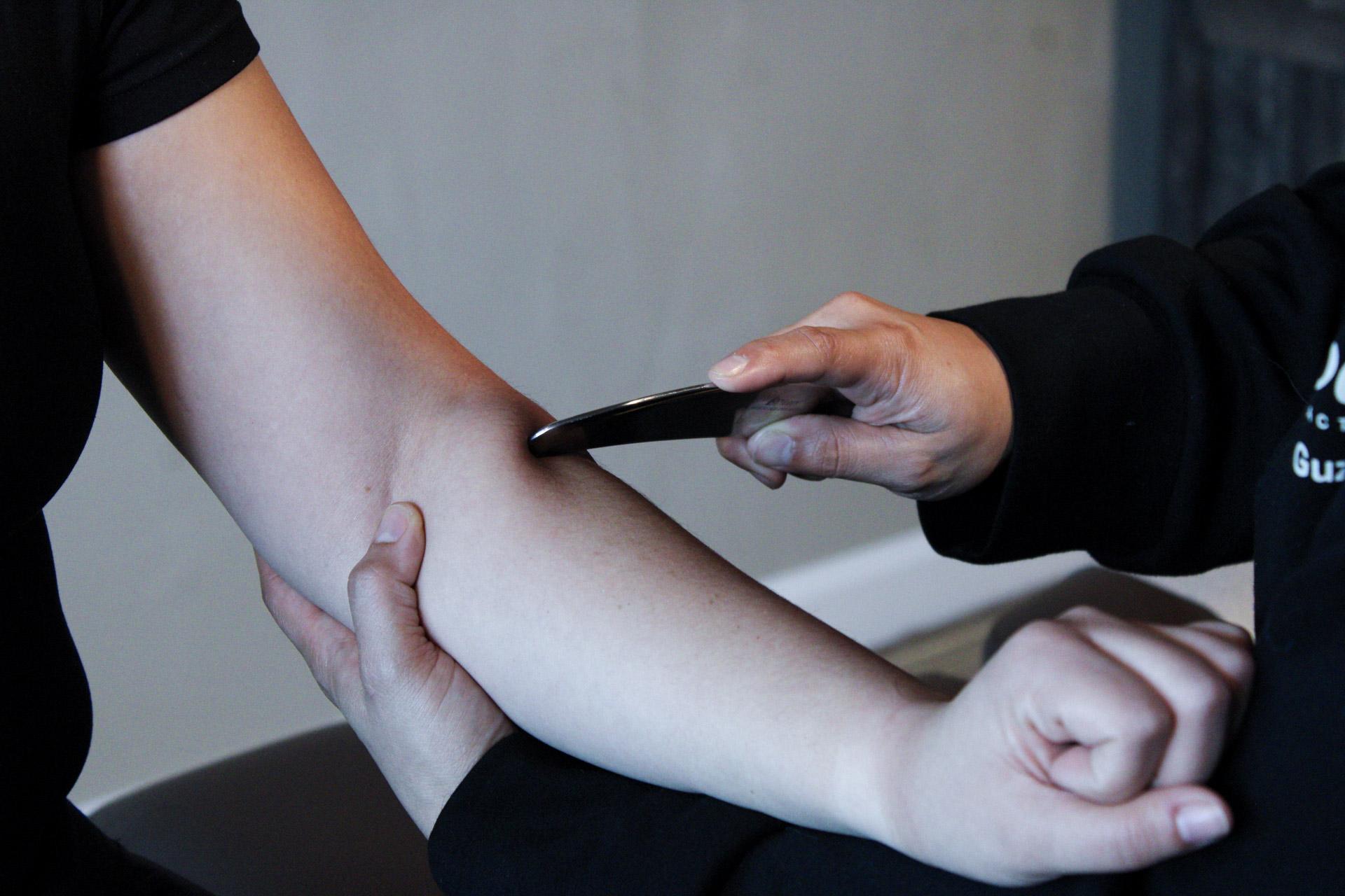 Graston / Scraping Therapy
